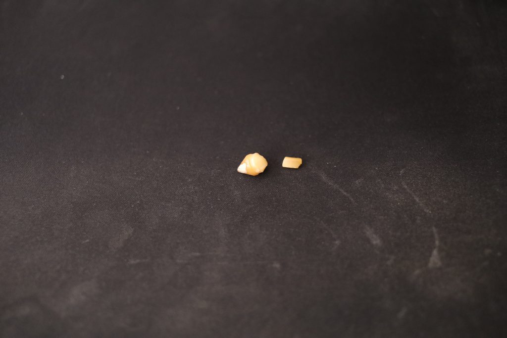 These are not fragments of a fallen tooth but broken pieces of a plastic plug sitting between your brake pedal and switch.